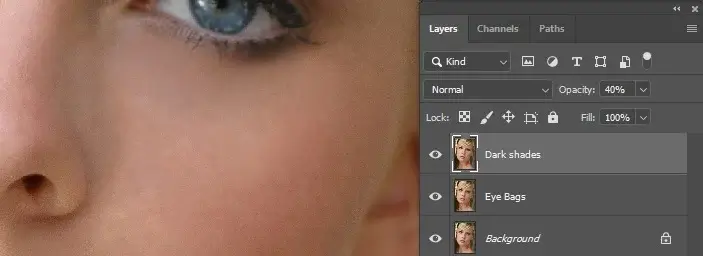 layer opacity adjustment for eye bags dark circles and wrinkles