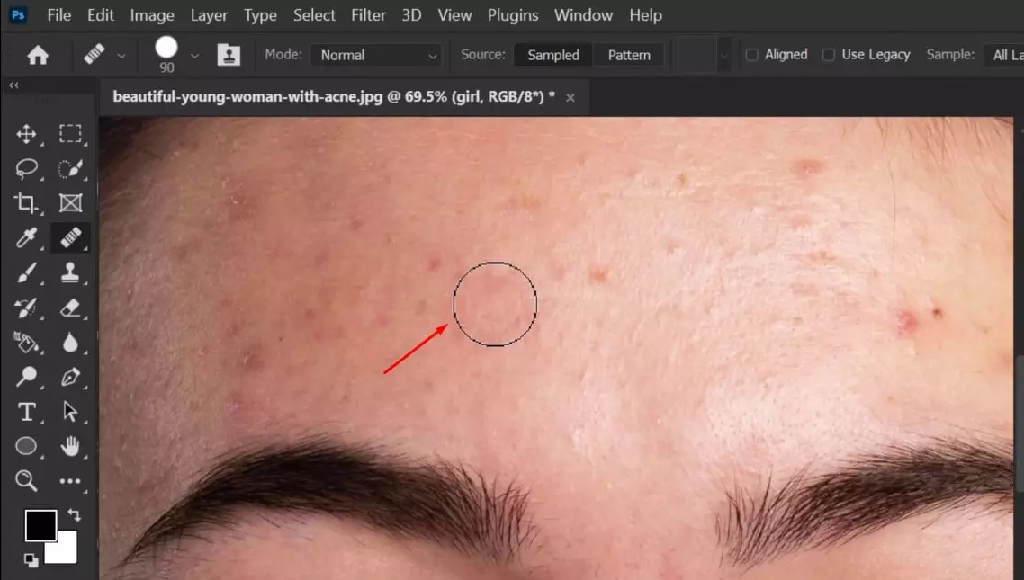 Remove Blemishes from Skin in Photoshop