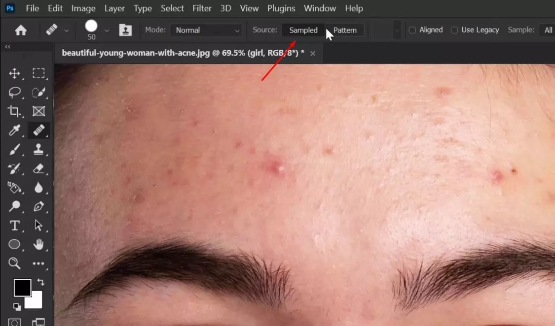 Remove Blemishes from Skin in Photoshop