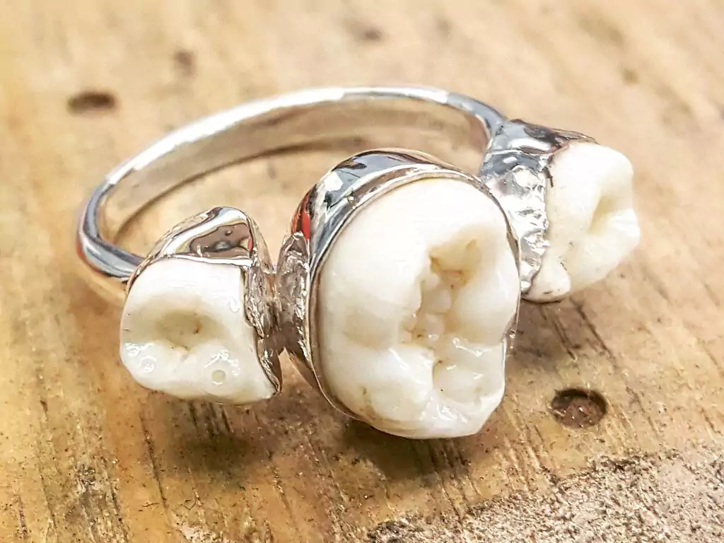 teeth wedding ring