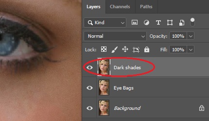 Eye bags, dark shades, wrinkle removal_Clipping World